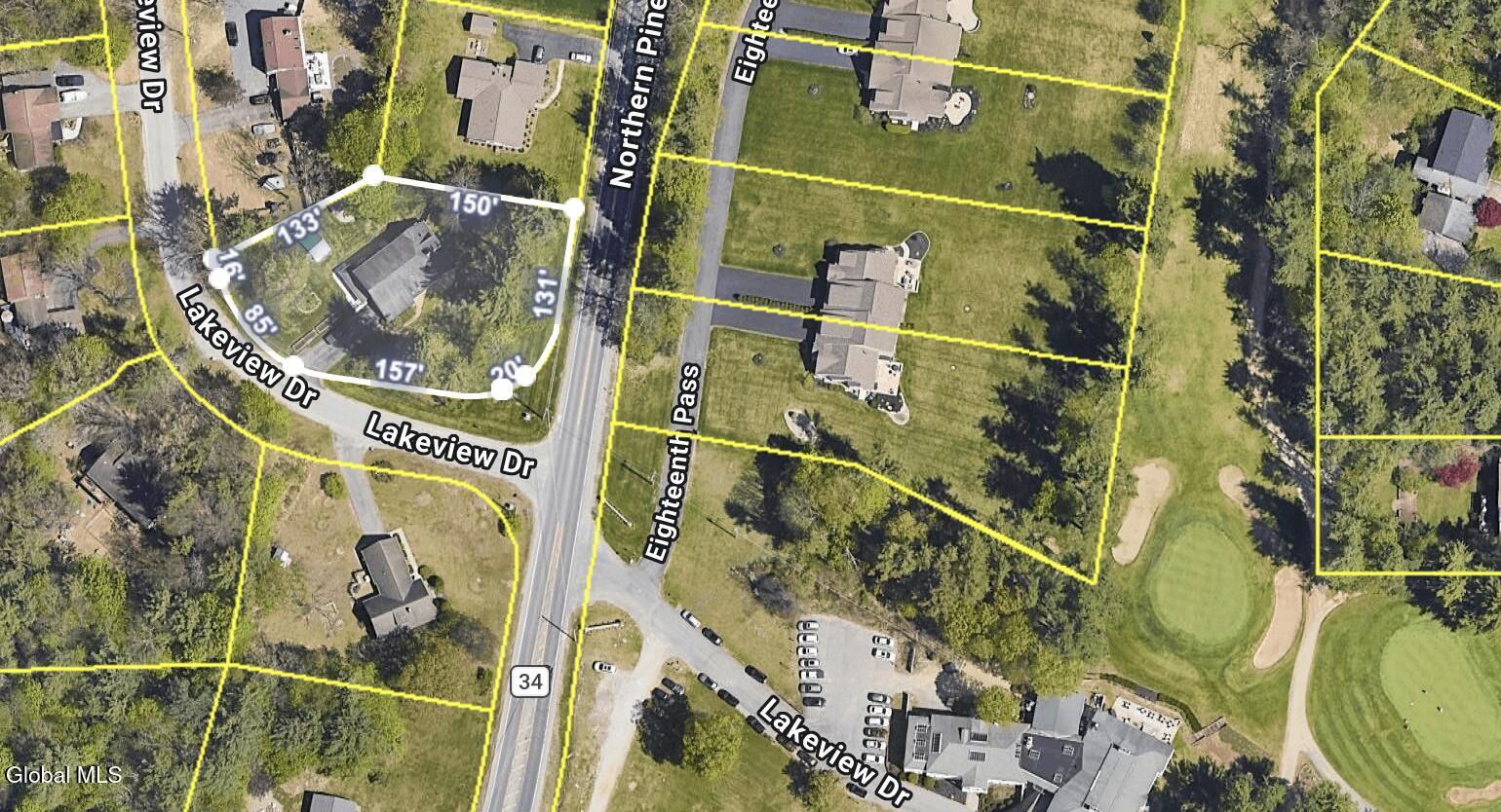 1 Lakeview Drive Gansevoort NY 12831
