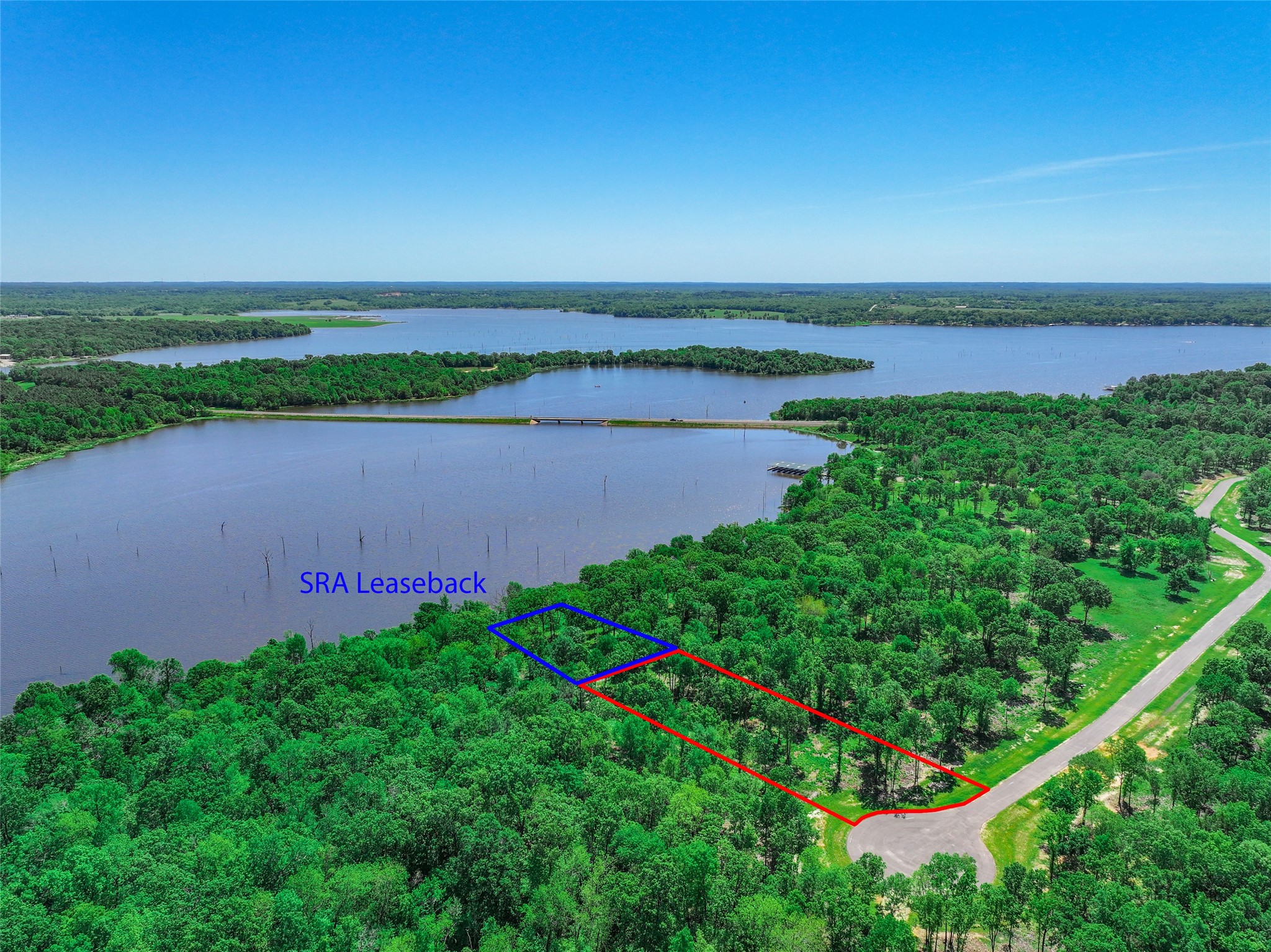 Tbd Private Road 5862 Yantis TX 75497